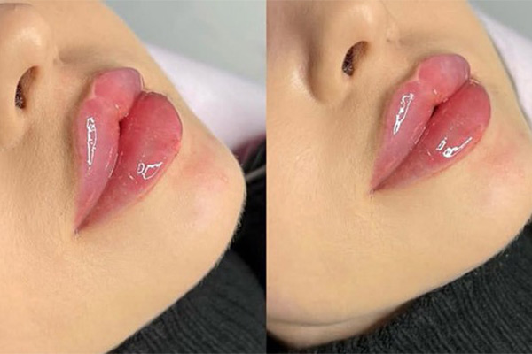 ژل لب مدل قلوه ای