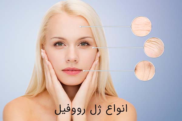 ژل رووفیل چیست؟