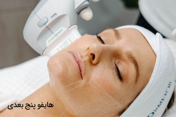 هایفو پنج بعدی