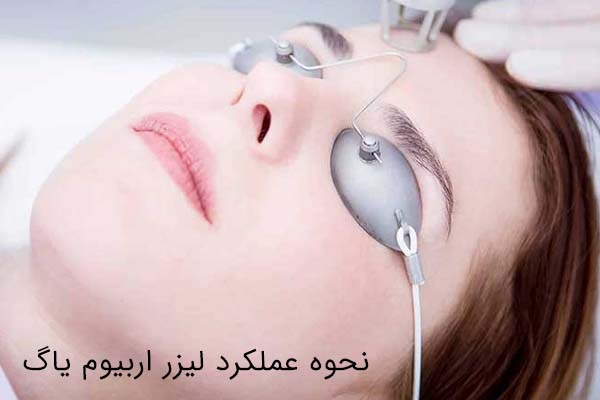 جلسات لیزر اربیوم