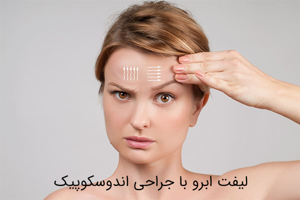 لیفت ابرو با جراحی اندوسکوپیک