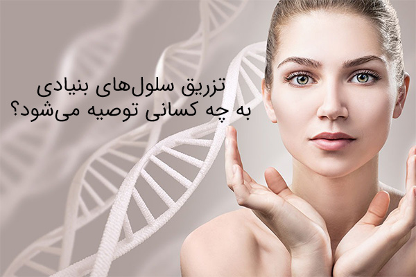 تزریق سلول‌های بنیادی