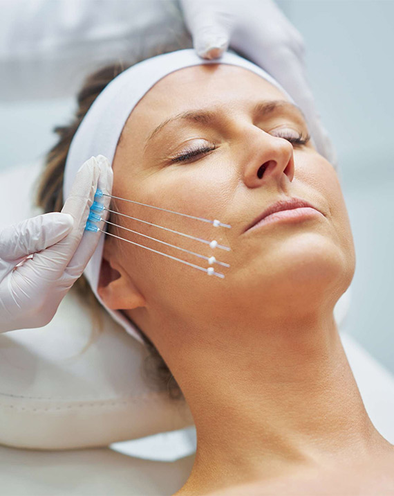 لیفت صورت با نخ