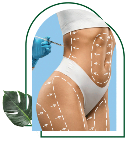 body-filler body-filler
